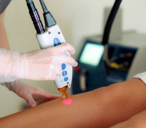 Laser-Hair-Removal-South-Yarra-1-1024x680